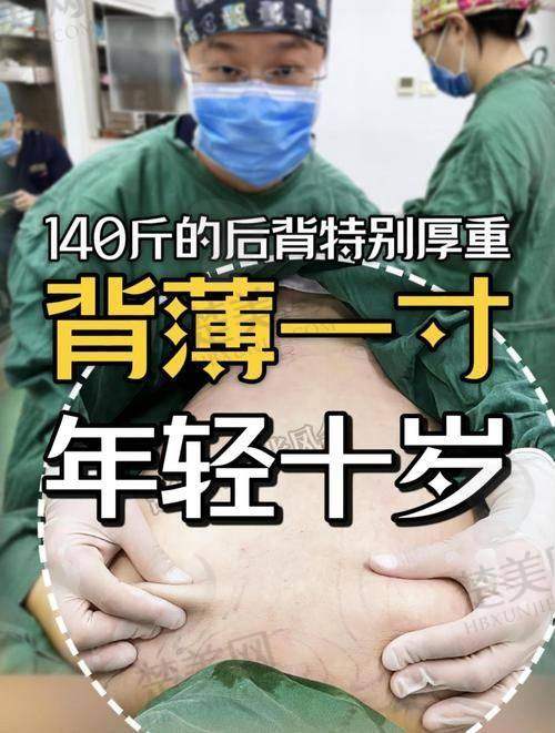 三、成都朱慧东医生的口碑亮点