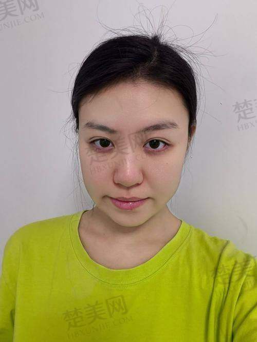 五、重庆铜雀台整形外科医院——精细整形的品质之选