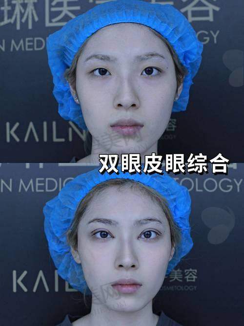 二、张小芸医生是乔雅登认准医生吗是真的吗？答案揭晓