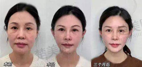 四、广州艺星王艳医生的服务与口碑