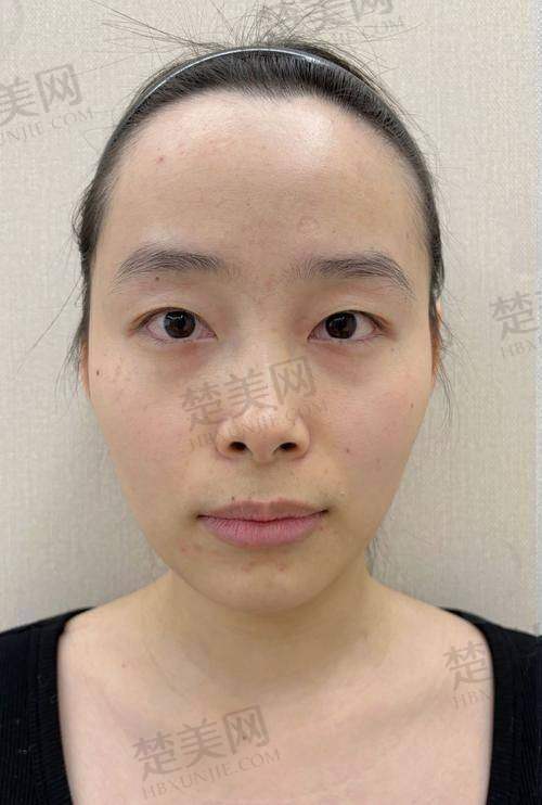 四、西安壹加壹医疗美容医院——人性化布局与高品质玻尿酸的结合