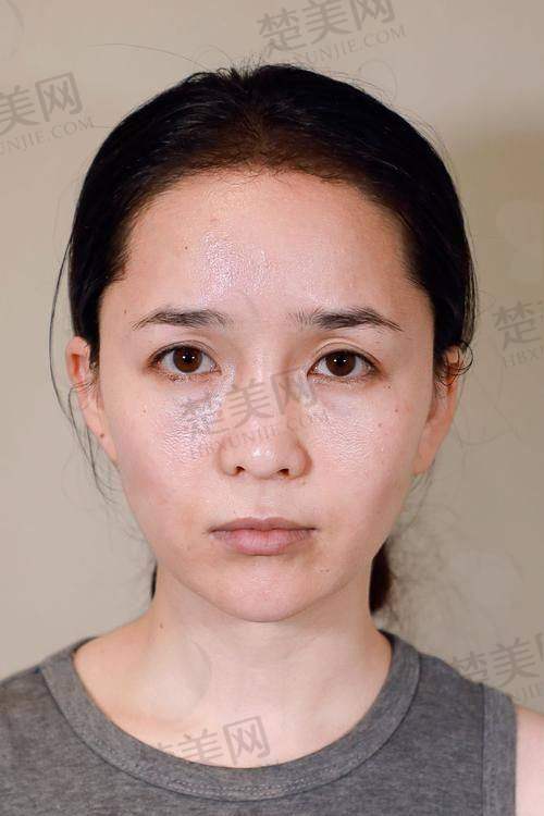 总结