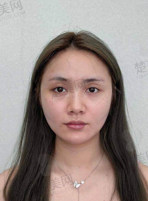 二、西安艺星医疗美容医院——西北地区的旗舰医美机构