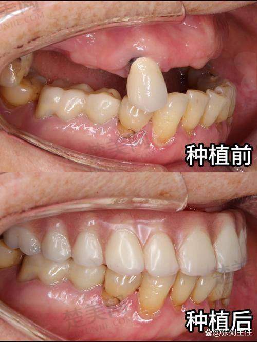 七、泉州美特尔口腔种牙宝龙店患者评价