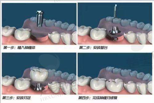 四、惠州市中医医院口腔科