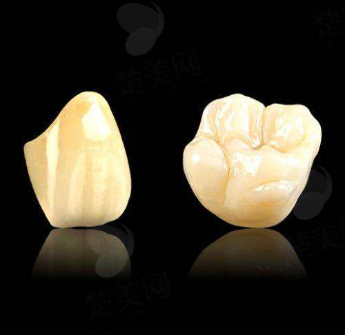 三、清远中恒口腔医院——性价比高的镶牙之选