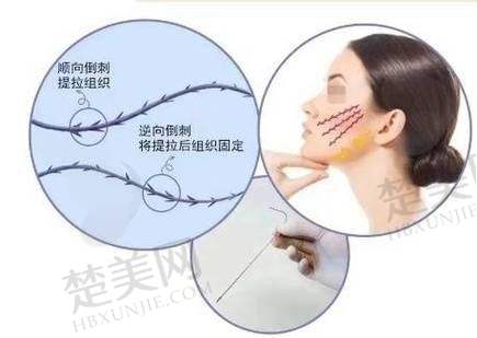 七、消费指南参考