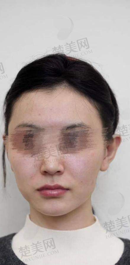 五、西安画美医疗美容医院