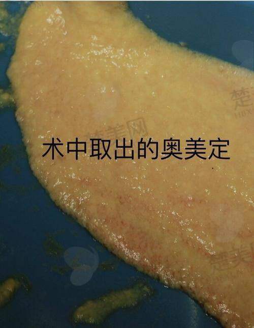四、其他可选择的医院