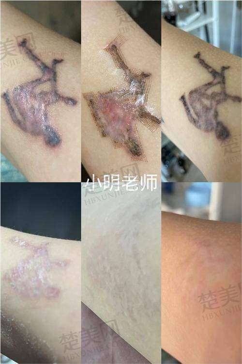 六、其他值得关注的祛疤医院