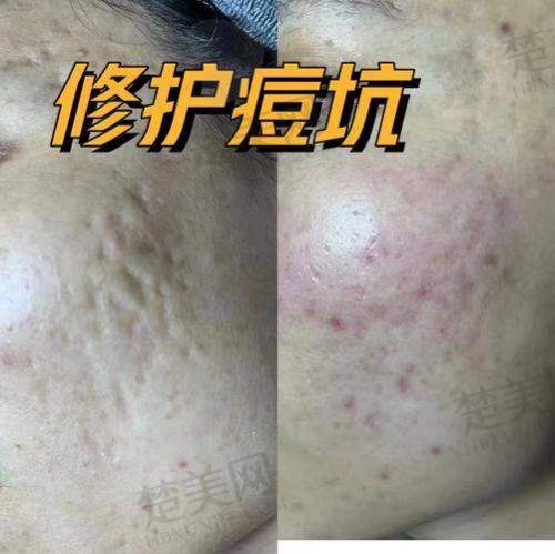 五、苏州大学附属儿童医院——儿童祛疤的温馨港湾