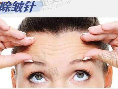 一、北京除皱针价格的总体情况