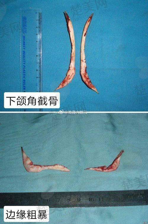 七、重庆松山医院的优势加持