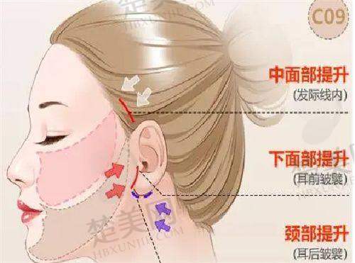 八、烟台美神科美医疗美容门诊部预约方式
