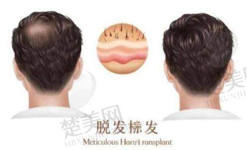 八、惠州麦穗医疗美容诊所（麦穗植发）预约方式