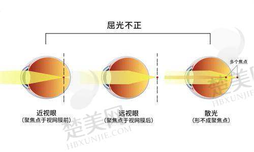 四、武汉佰视佳眼科医院的服务体验