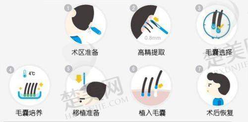 六、惠州麦穗医疗美容诊所（麦穗植发）价格表