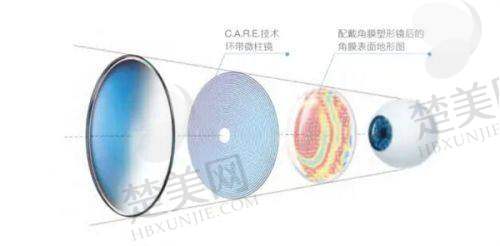 五、郑州爱尔眼科医院怎么样:性价比高服务优