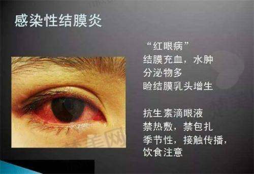 三、武汉佰视佳眼科医院的特色优势项目