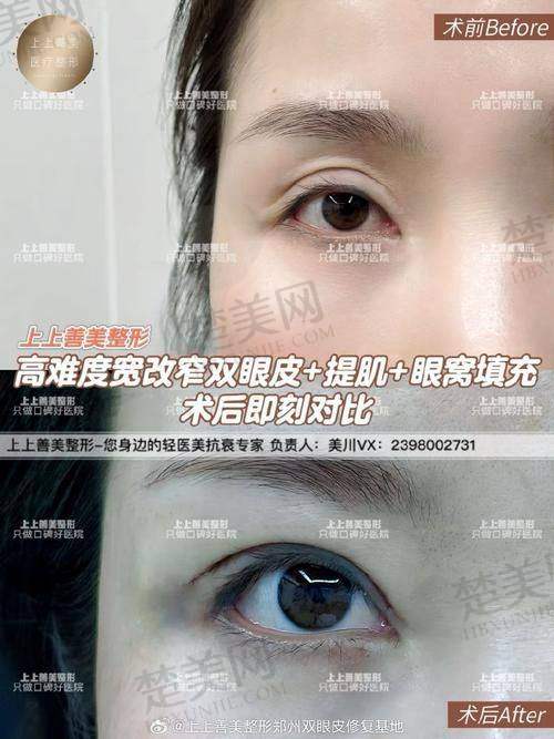 二、上海九院部分双眼皮医生介绍