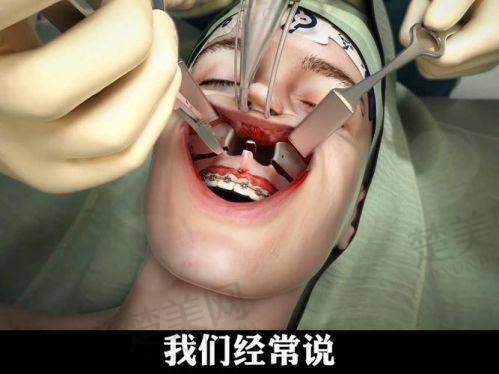 六、艾伟健正颌手术风险与应对策略