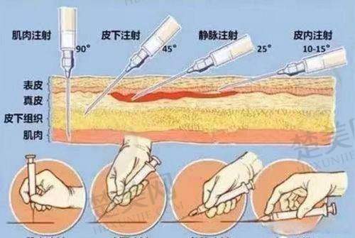 三、徐海艇医生 - 温州医 科 大学附属第二医院