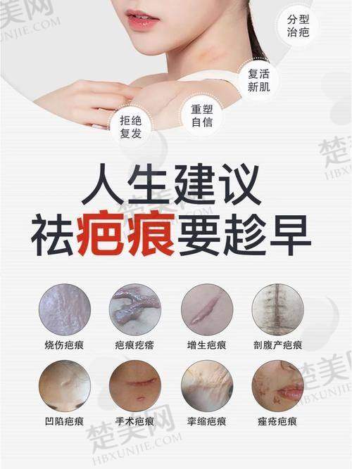 （八）激光净肤价格