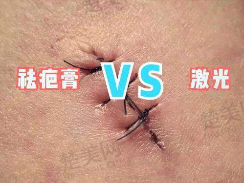 （五）注射淡疤价格