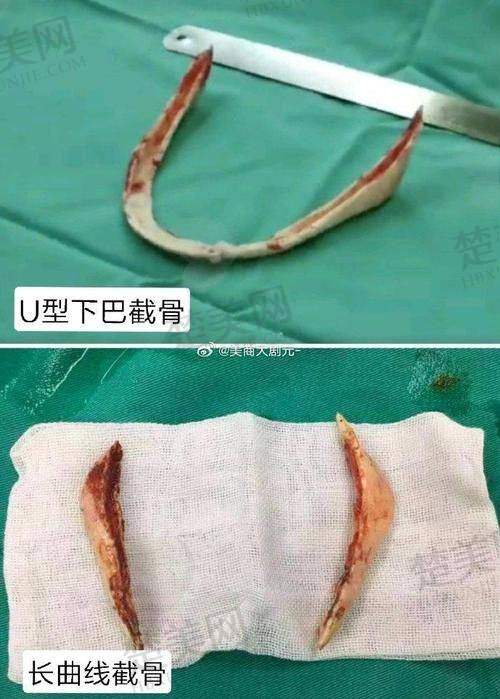 六、胡朝晖医生怎么预约？