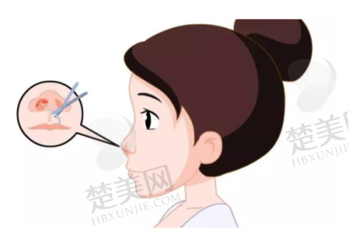 一、厦门国有医院假体隆鼻医院排名情况