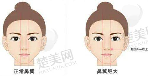 一、连云港媚眼医疗美容门诊部正规吗？