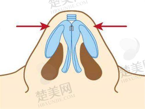 一、大庆艾尚美颜医疗美容门诊部正规吗?