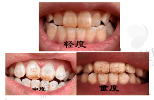 哈尔滨中航口腔医院价格表