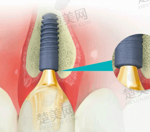 三、佳木斯欧莱德口腔门诊部诊疗项目有哪些？
