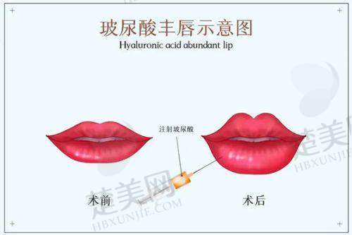 五、总结：深圳名丽医疗美容医院到底值不值得选