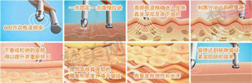 三、连云港媚眼医疗美容门诊部诊疗项目有哪些？