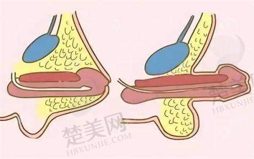 八、徐州心源美容医院预约方式