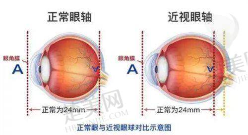 三、佳木斯爱视眼科医院诊疗项目有哪些？