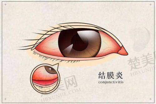 三、哈尔滨华厦眼科医院诊疗项目有哪些？