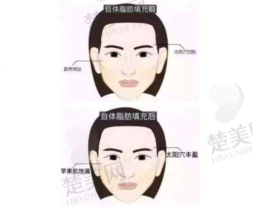 八、苏州圣爱整形医院预约方式