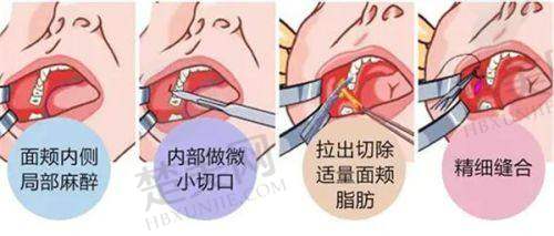 五、深圳阳光医院口腔项目收费一览