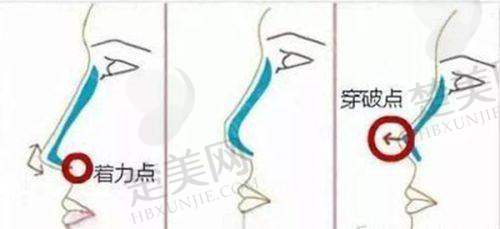 二、长春绿园铭誉医疗美容诊所怎么样？