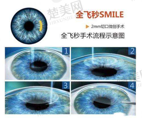 八、哈尔滨华厦眼科医院预约方式