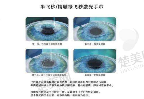 八、佳木斯爱视眼科医院预约方式