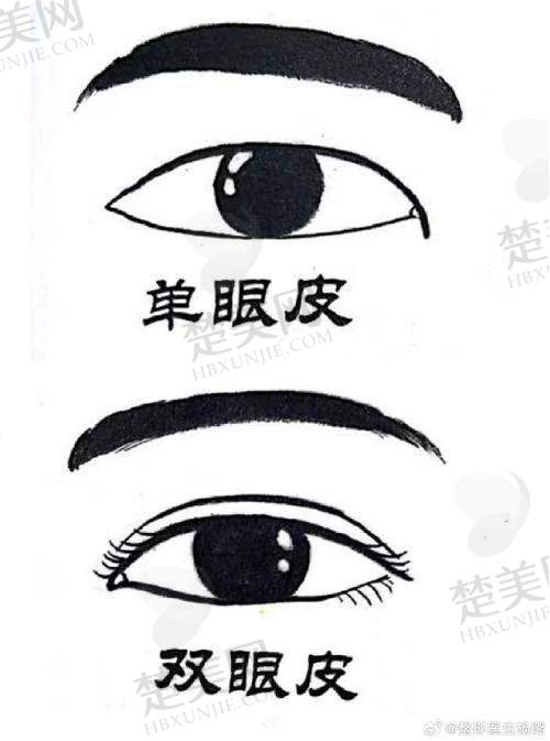 五、选择冯少清眼综合手术的注意事项