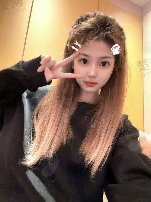 二、不同类型的徐文龙鼻子实例解析