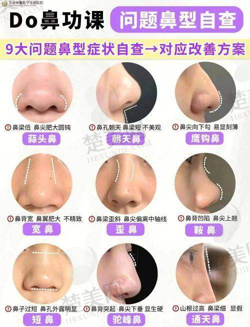 四、如何预约牛永敢医生的手术