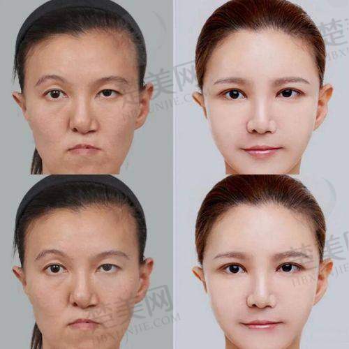 一、汪树杰简介