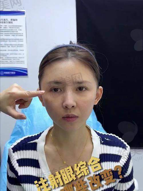 八、行业洞察：玻尿酸注射的三大误区与正解
