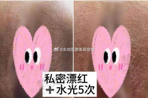 六、选择北京嘉禾医院开启私密美丽新旅程